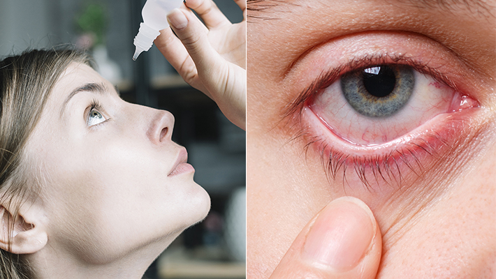 Conjunctivitis : Ignoring these warning signs is a big problem.