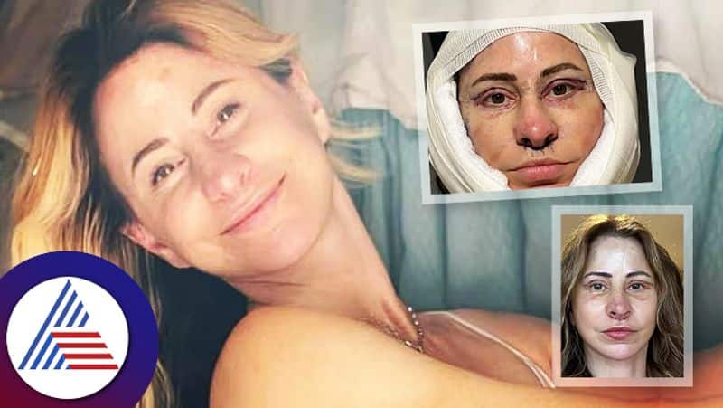 Woman Sold Her House For Facelift Plastic Surgery Living In Van Now roo