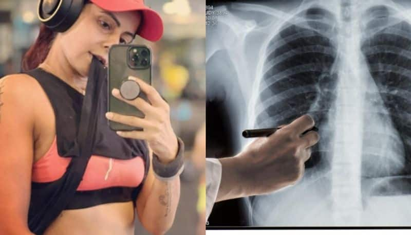 chhavi mittal informs followers that she caught a disease costochondritis hyp