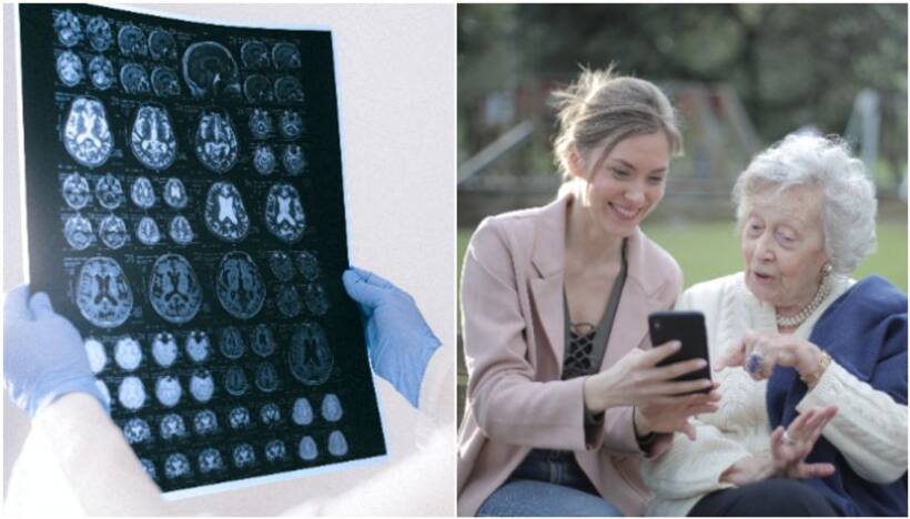 Effective strategies to prevent Alzheimer's risk and promote Brain Health