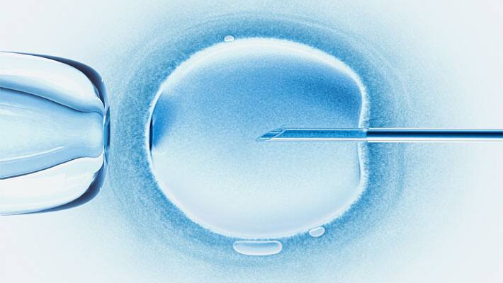 IVF