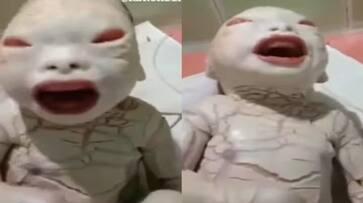 World viral women gave birth child with harlequin ichthyosis disorder people says alien kxa 