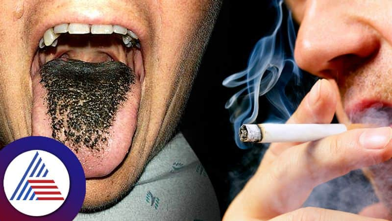 Cigarette Smokers Should Be Careful If You Get This Disease Your Tongue Will Turn Green roo