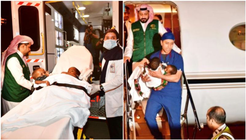 gulf news Tanzanian conjoined twins arrive in Riyadh for surgery rvn 