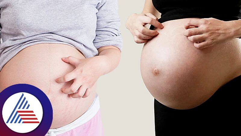 Reasons for belly itching during pregnancy women care health pav 