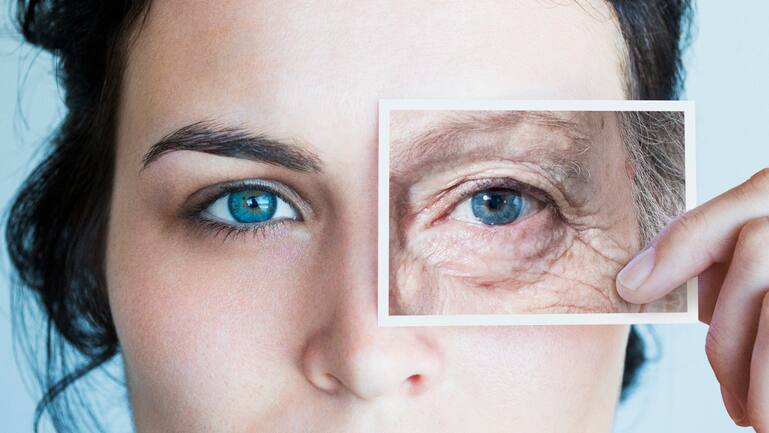 Skin Aging