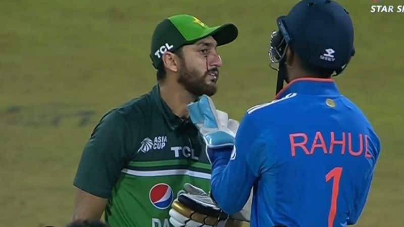 Asia Cup 2023 Pakistan Cricketer Left Bleeding After Injury KL Rahul Gesture Goes Viral kvn