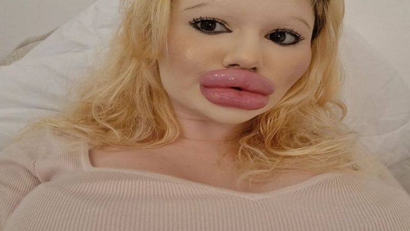 viral news girl name andrea Ivanvoa having world biggest lips know the story kxa 