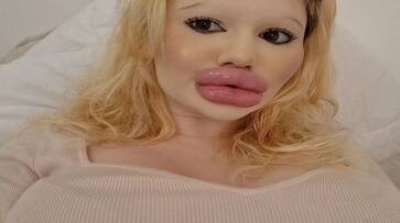 viral news girl name andrea Ivanvoa having world biggest lips know the story kxa 