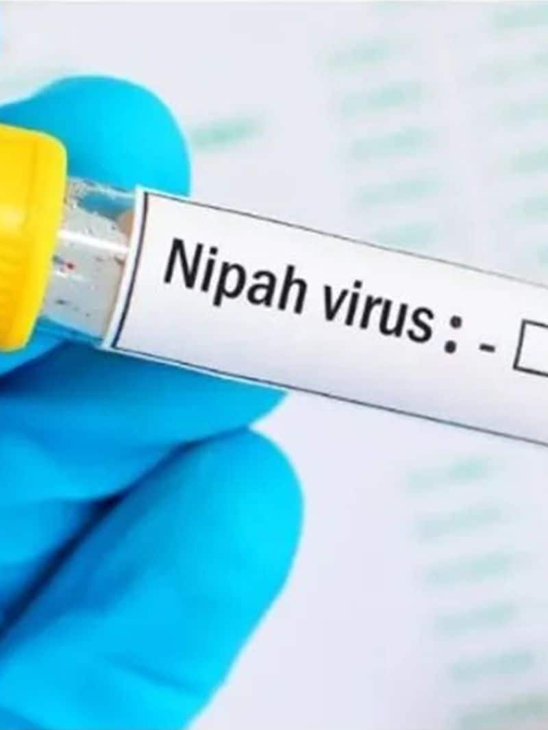 Nipah alert: Prevention tips you need to be aware of rkn eai