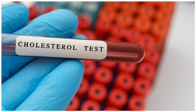 High Cholesterol Test.. Important Things You Should Keep In Mind.. Rya