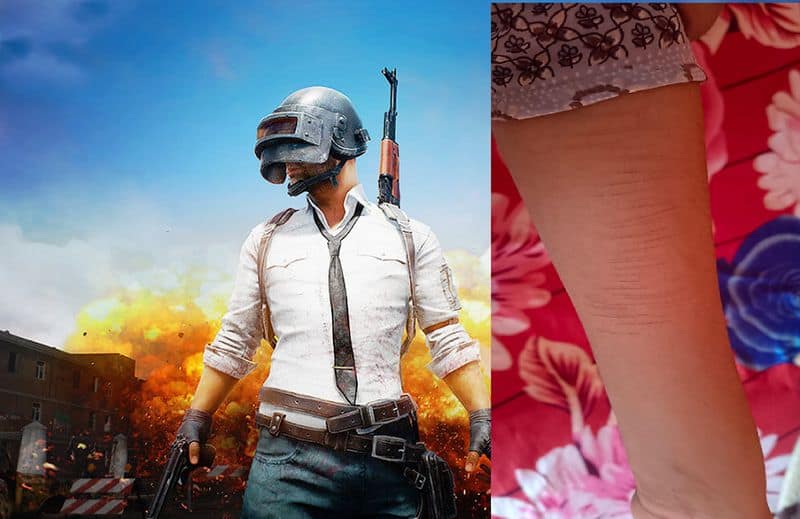 Pubg effect dandeli private school girls have injures there hands themselves gvd