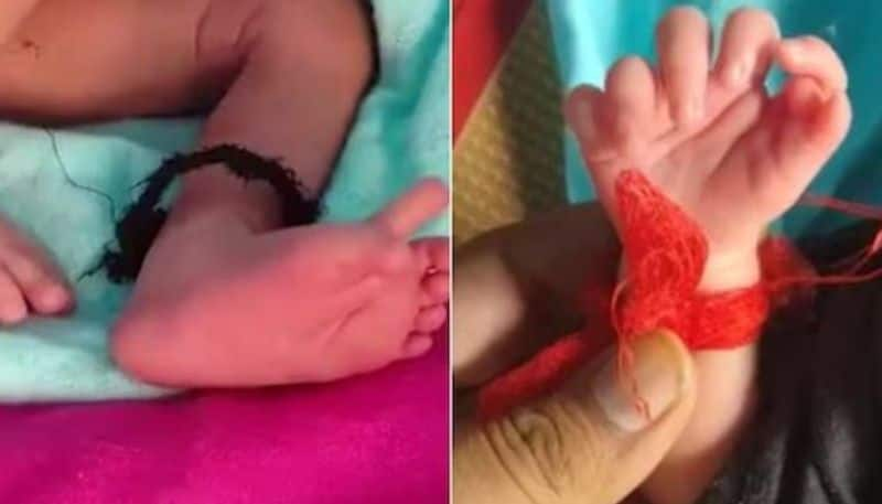  Baby born with extra fingers, family calls her incarnation of goddess