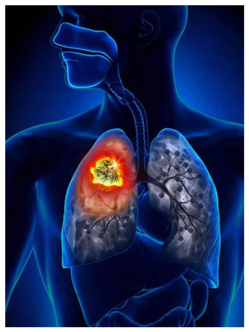 world lung day 2023 eat these foods for healthy lungs-rse- 