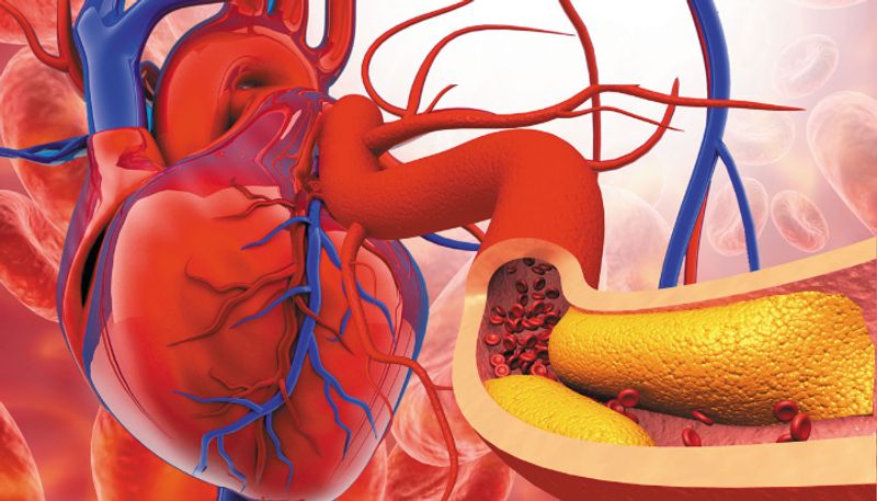 World Heart Day 2024: Know how your genes, lifestyle affect heart disease risk in familial hypercholesterolemia RBA