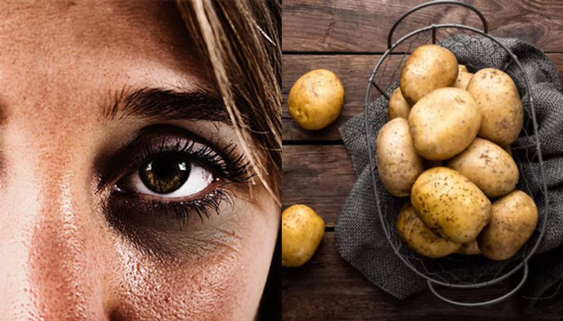 how potato helps in removing dark circles azn 