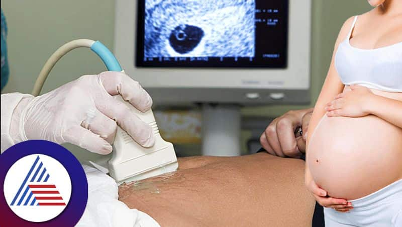 How Often Is Ultrasound Necessary During Pregnancy And When Should It Be Done roo 