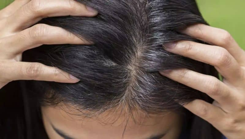 factors that contribute to premature greying of hair azn 