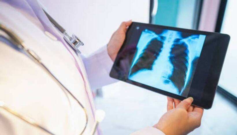 WHO hails India for reducing TB cases at almost double the rate than rest of the world