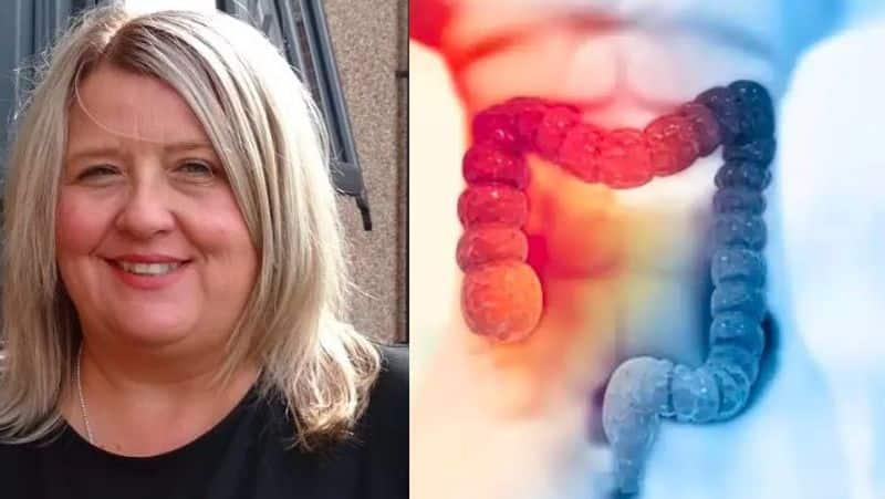 Medical Miracle Woman from wales suffering from stage 3 colorectal cancer is completely cured by Dostarlimab Injection akb