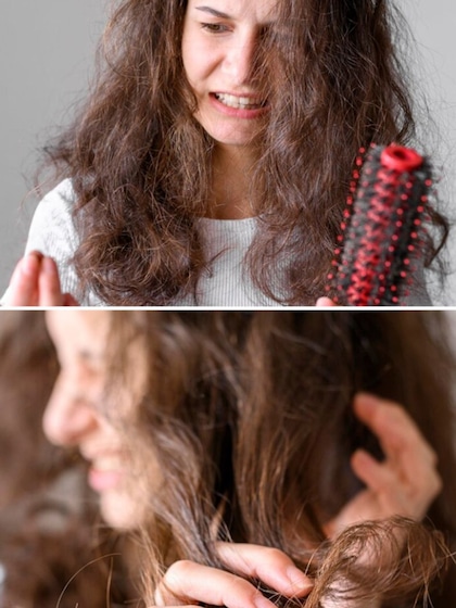 Having Hair loss? 7 ways to tackle hair fall in winter
