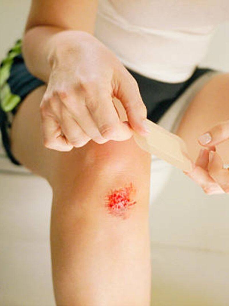 best home remedies for wound healing in tamil mks