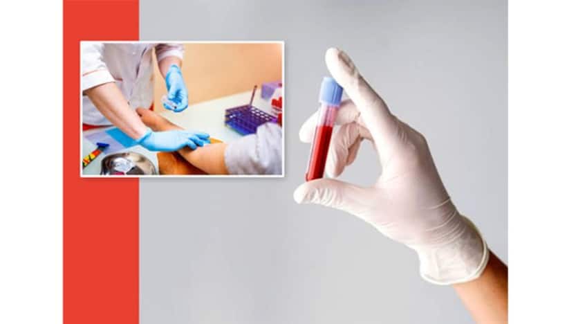 The Advantages of Taking a Blood Test at Home
