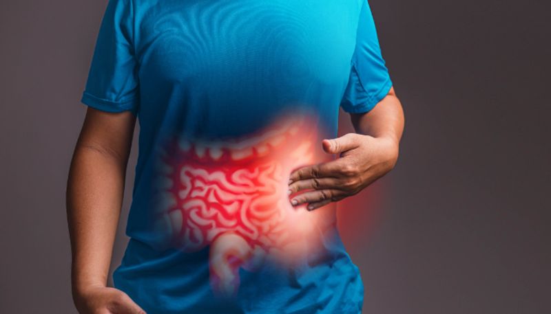 7 foods to increase good bacteria in your gut azn 