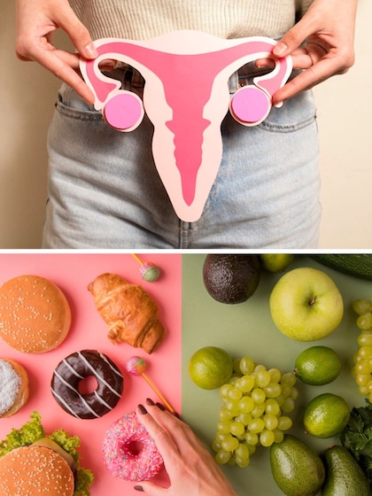 Suffering from PCOS? Just avoid these 7 food items