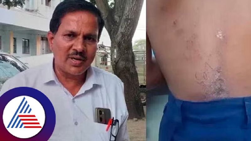 A case of throwing acid on a student Head teacher rangaswamy suspended and FIR at chitradurga district rav