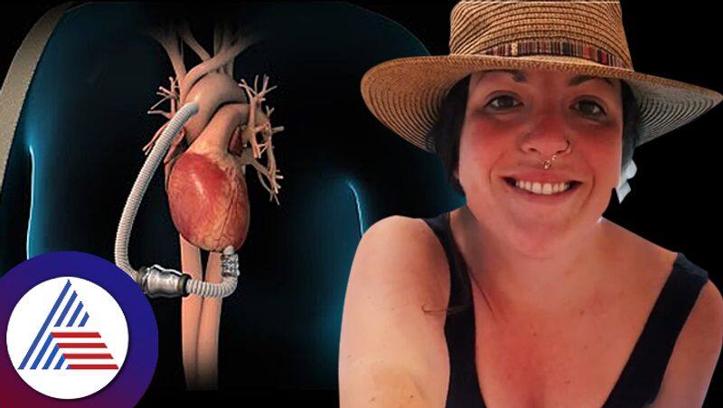 Us Boston Woman Runs On Batteries Due To Heart Disease No Pulse In Body roo