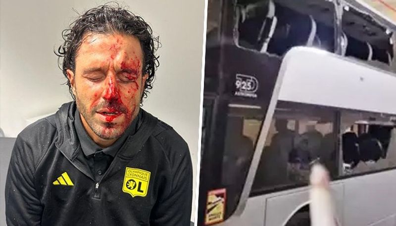 Football Drama in Ligue 1 after Lyon manager injured in violent team bus attack in Marseille; WATCH shocking footage osf