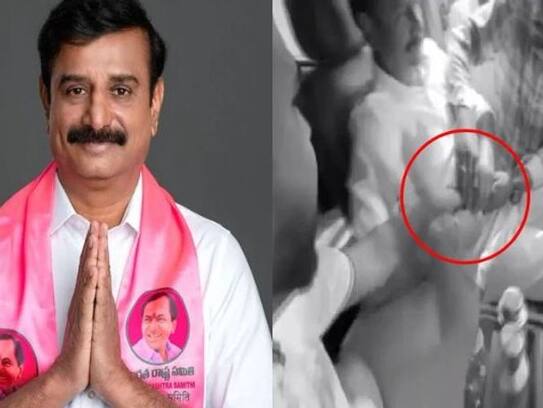 Police case on accused in attack over BRS MP Kotha Prabhakar Reddy ksm