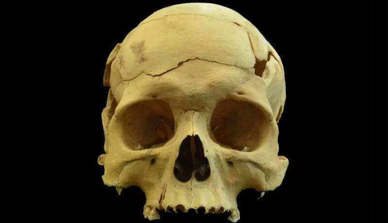 Fascinating Skull found in China reveals advanced brain surgery performed 2,700 years ago snt