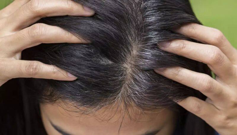 nuts to prevent premature greying of hair