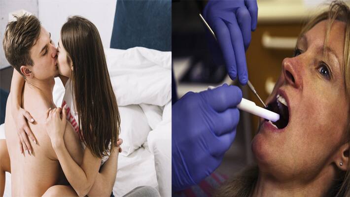 Throat Cancer