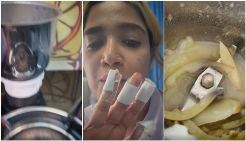 singer abhirami suresh injured during food vlogging mixer explode vvk