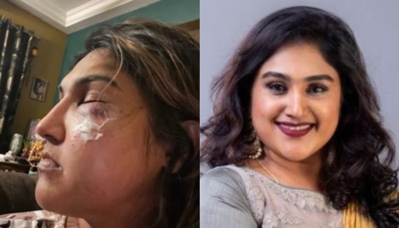 Vanitha Vijayakumar attacked actor blames Pradeep Antonys supporter Bigg Boss controversy hrk