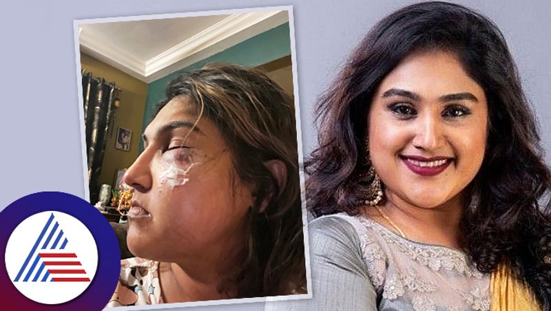 Tamil actress Vanitha Vijaykumar attacked by unknown person in Tamil Nadu srb