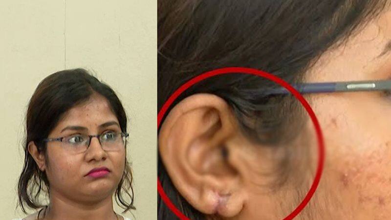 Young woman ear rotted due to wrong medicine tvk