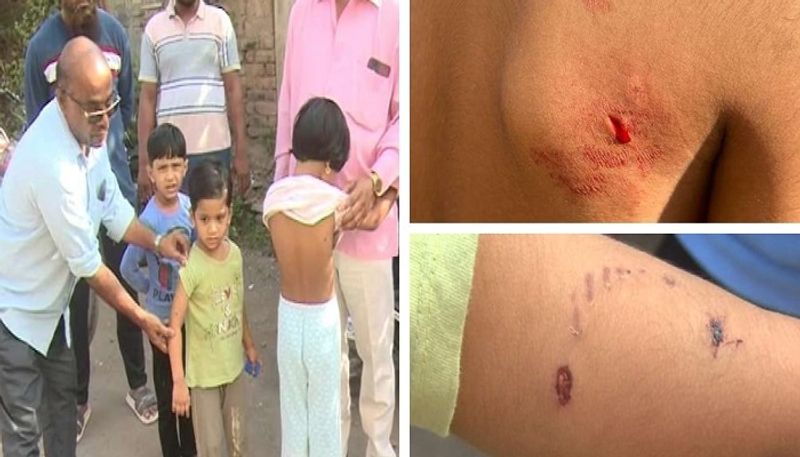 Stray Dogs Attack on Children in Vijayapura grg 