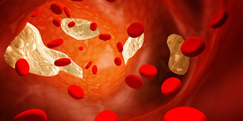 lifestyle changes to lower cholesterol levels