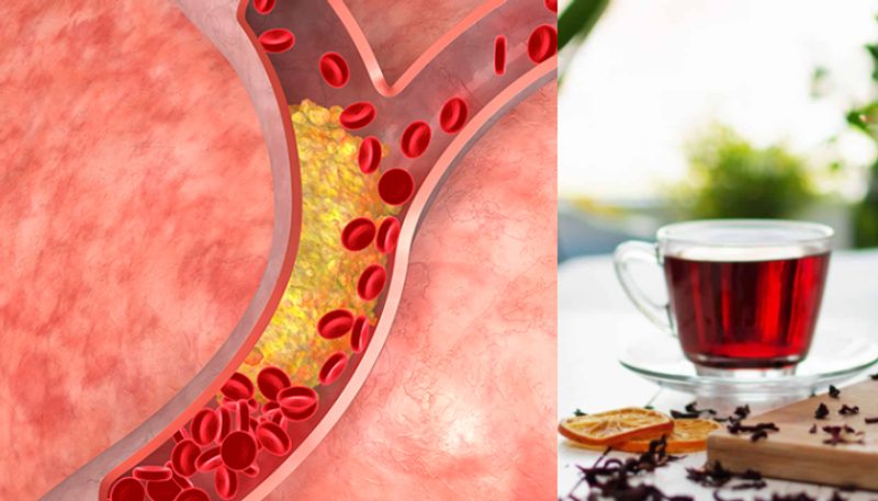 benefits of hibiscus tea you must know