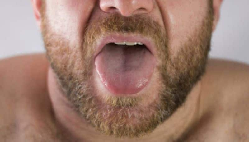 colour  change on tongue indicates different health issues or disease rsl