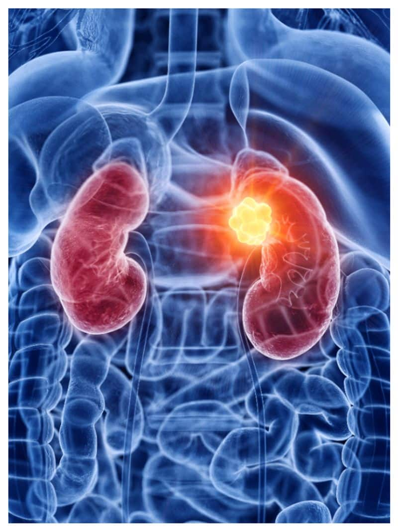 six habits that affect kidney health