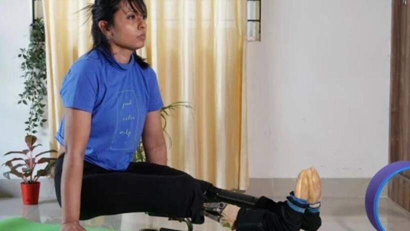 एक्सीडेंट में खो दिए दोनों पैर, हिम्मत के दम पर एम्प्यूटी लेग्स से बन गईं योगा टीचर
