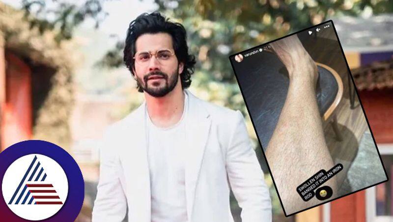 Varun Dhawan suffers leg injury while shooting for upcoming project, shares update on Instagram suc