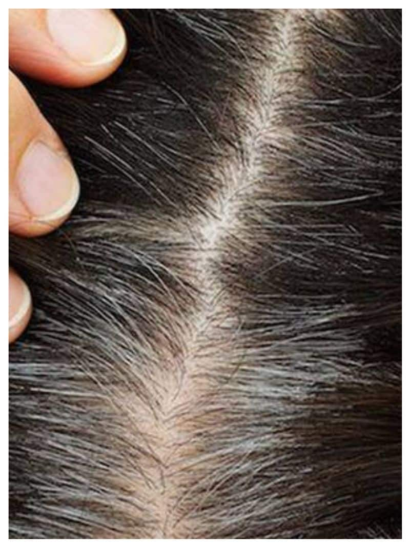 follow these tips for white hair turn to black color rsl