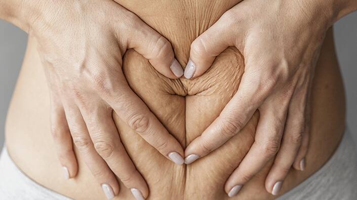 3 homemade scrubs that can remove stretch marks