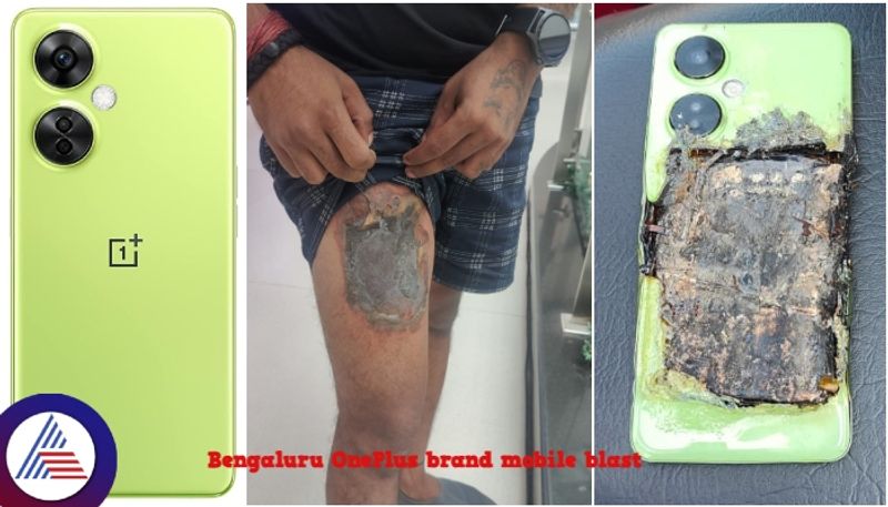 Bengaluru OnePlus brand mobile blast injured Whitefield young man thigh sat